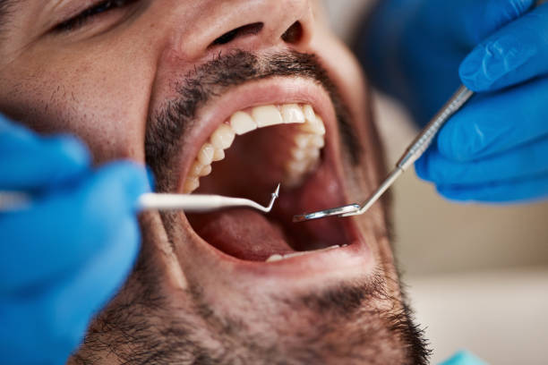 Urgent Tooth Repair in NJ